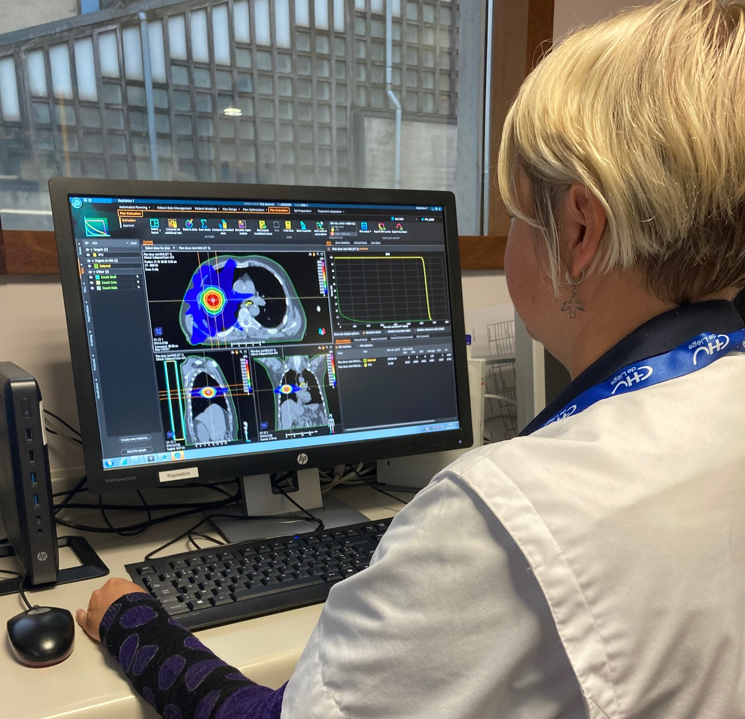 preparation traitement radiotherapie 1512x2016px